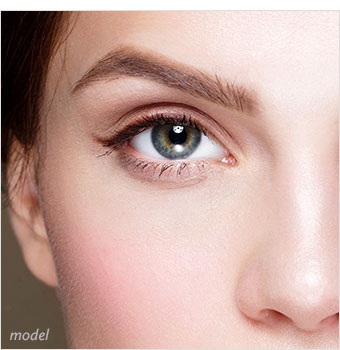 Non-Excisional Eyelid Lift