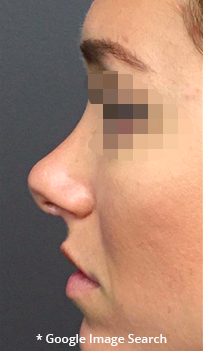 Woman's Nose Profile