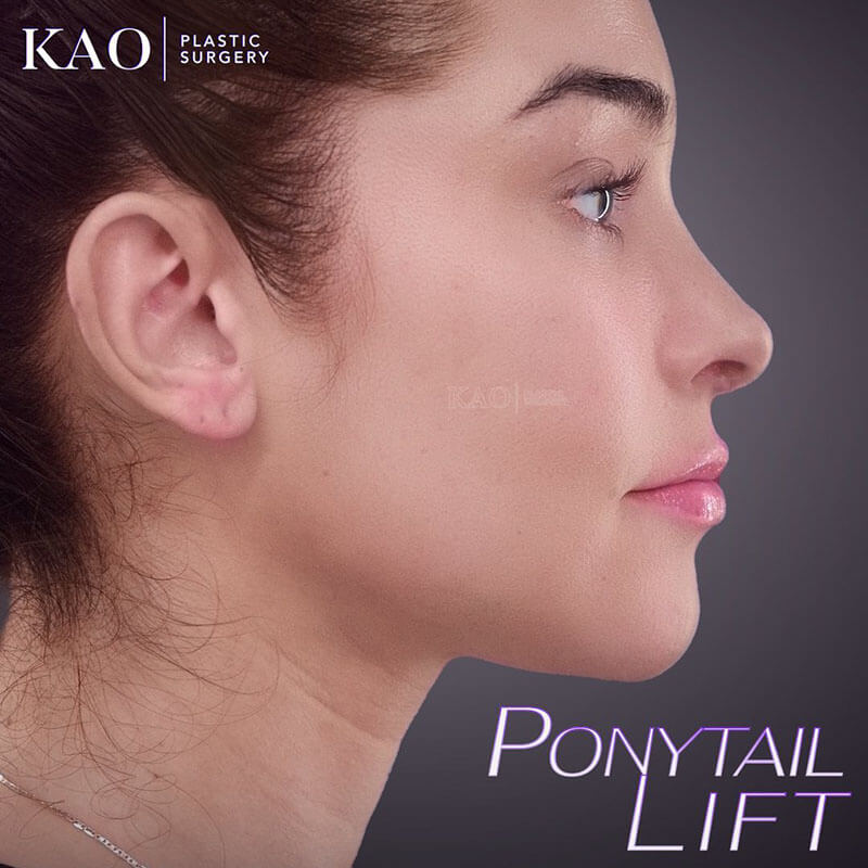 Ponytail Lift Results